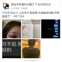 疑似屈楚萧女友再发文控诉   指男方劈腿晒受伤照用词过激