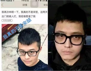 (图左伤不起的网友,图右事件宋喆)