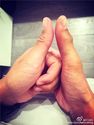 图片说明