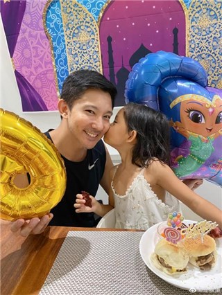 立威廉陪女儿玩闹被踢到眼睛！“视网膜剥离” 急手术险瞎眼