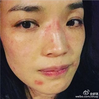 图片说明