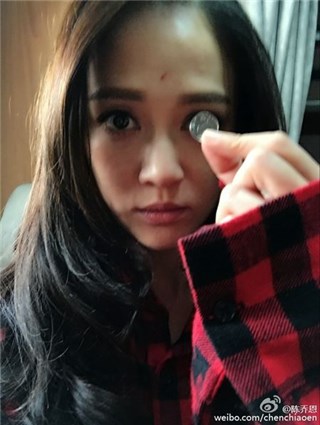会玩儿！陈乔恩拿硬币量大眼睛 额头「天眼」伤抢镜