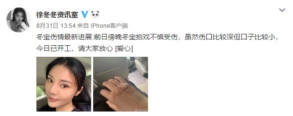 徐冬冬伤后迅速复工！导演制片赞：好演员心里戏大於一切