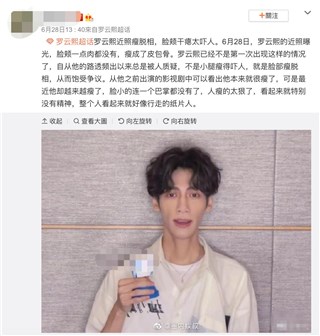 罗云熙暴瘦脱相被传身体出问题   本尊发无P图照辟谣